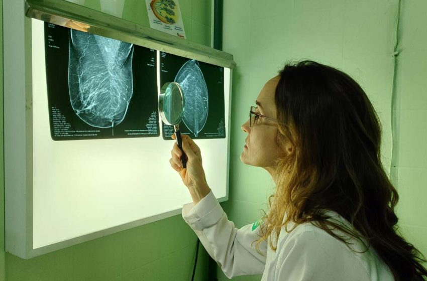  Saúde Ceará incrementa número de mamografias realizadas e amplia chances de diagnóstico precoce de câncer de mama