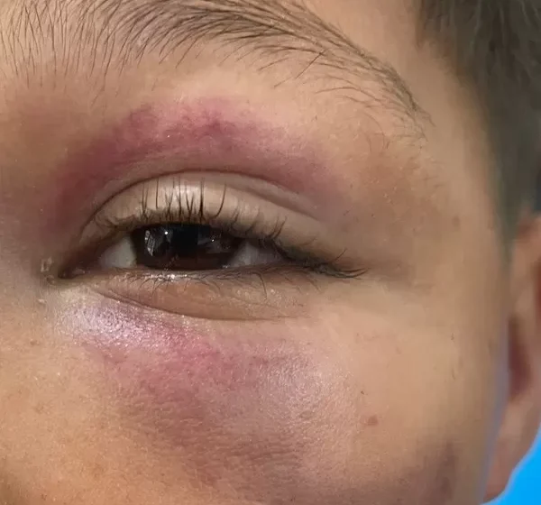  Homem é preso após agredir uma criança autista por ele estar brincando na rua em Belém