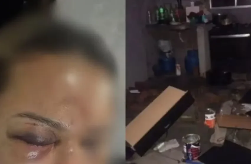  Mulher é agredida com socos pelo companheiro após discussão em São José de Ribamar